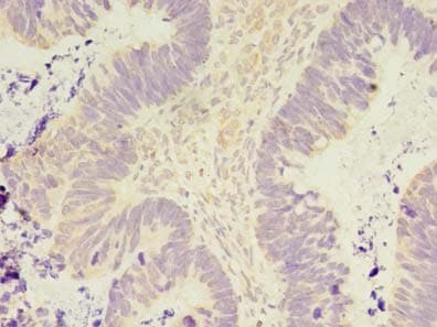 PELO Antibody