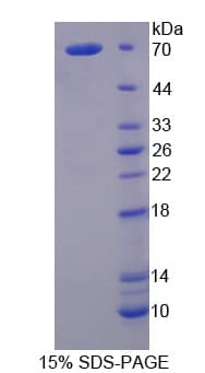 Bovine FGA / Fibrinogen Alpha Protein (Recombinant His)
