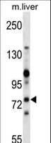 ZAP70 Antibody (aa530-558)