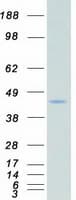 Human CSNK2A2 Protein (Recombinant Myc-DDK (Flag))