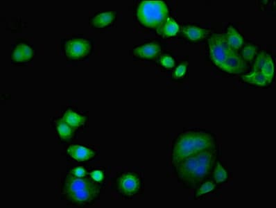 TAMM41 / C3orf31 Antibody