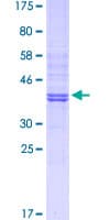 Human GSN / Gelsolin Protein (Recombinant GST, N-terminus)