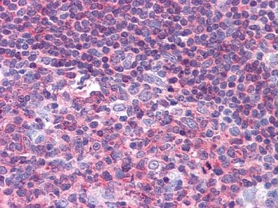 Monoclonal Mouse anti-Human PTK2B / PYK2 Antibody (clone 5E2D5, Amino Acid: 815-997, IHC, WB)