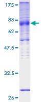 Human SLC2A5 / GLUT5 Protein (Recombinant GST)