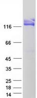 Human ANPEP / CD13 Protein (Recombinant Myc-DDK (Flag))