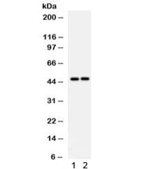 Polyclonal Rabbit anti-Human PTPN2 / TC-PTP Antibody (IHC, WB)