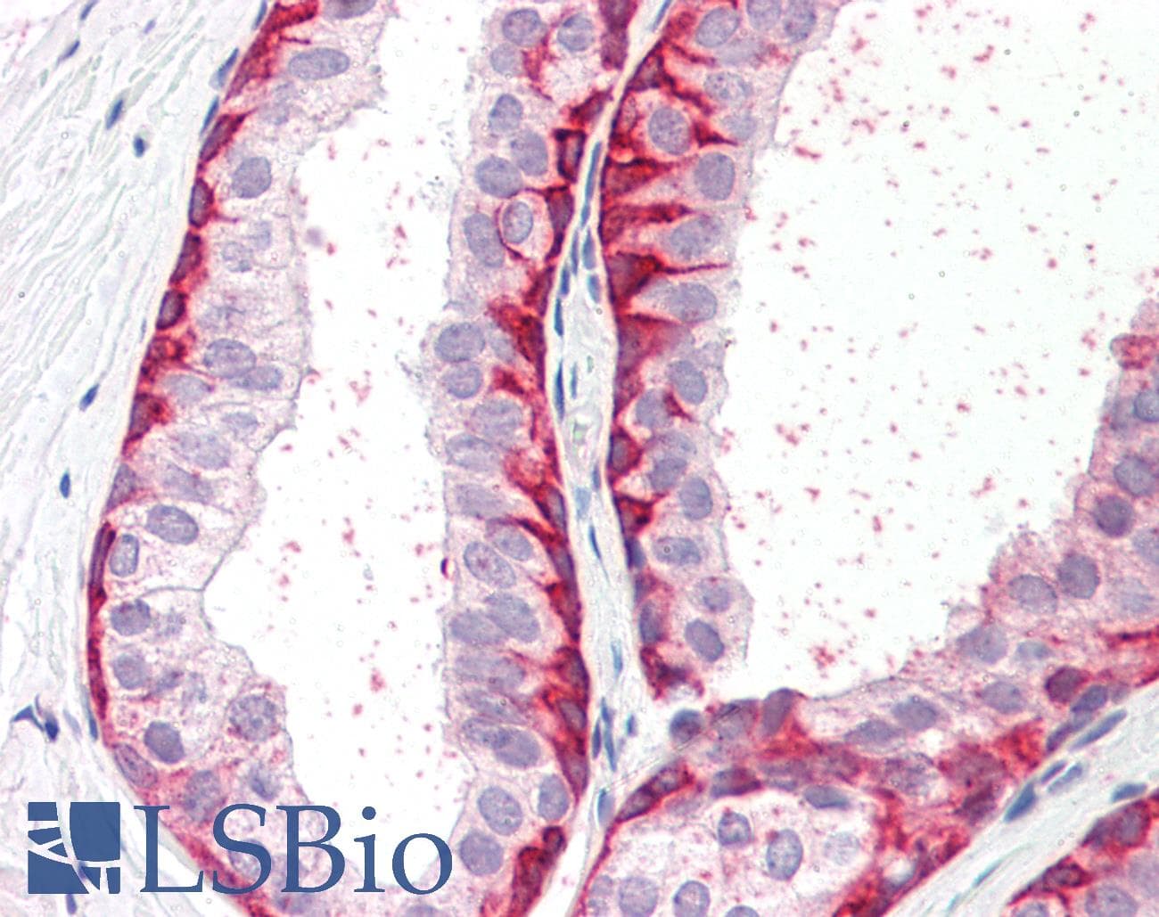 IHC-plus™ BRN2 / POU3F2 Antibody