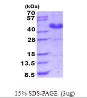 Human ASRGL1 Protein (Recombinant His)