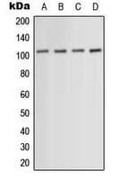 ACTN1+2+3+4 Antibody (N-Terminus)