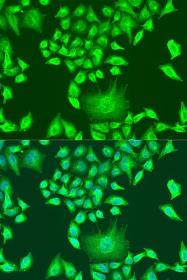 Polyclonal Rabbit anti-Human APOA1 / Apolipoprotein A 1 Antibody (IHC, IF, WB)