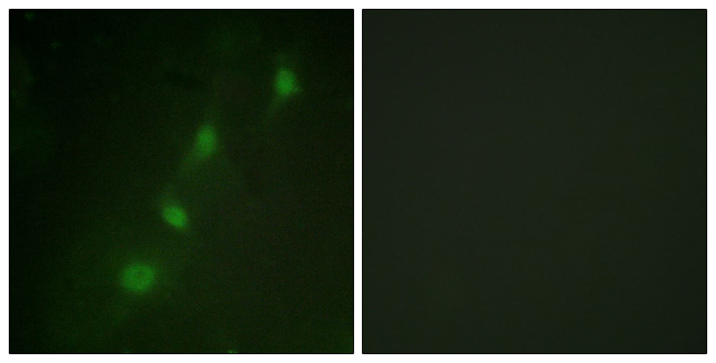 SGK1 / SGK Antibody (aa41-90)