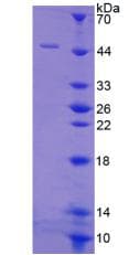 Rat VTN / Vitronectin Protein (Recombinant His, N-Terminal)