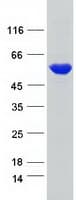 Human DARS Protein (Recombinant Myc-DDK (Flag))
