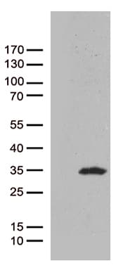 Monoclonal Mouse anti-Human CAV1 / Caveolin 1 Antibody (clone OTI2C4, Carrier-free, aa2-104, IHC, WB)