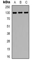 EGF Antibody (Internal)