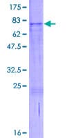 Human RUSC1 Protein (Recombinant GST)