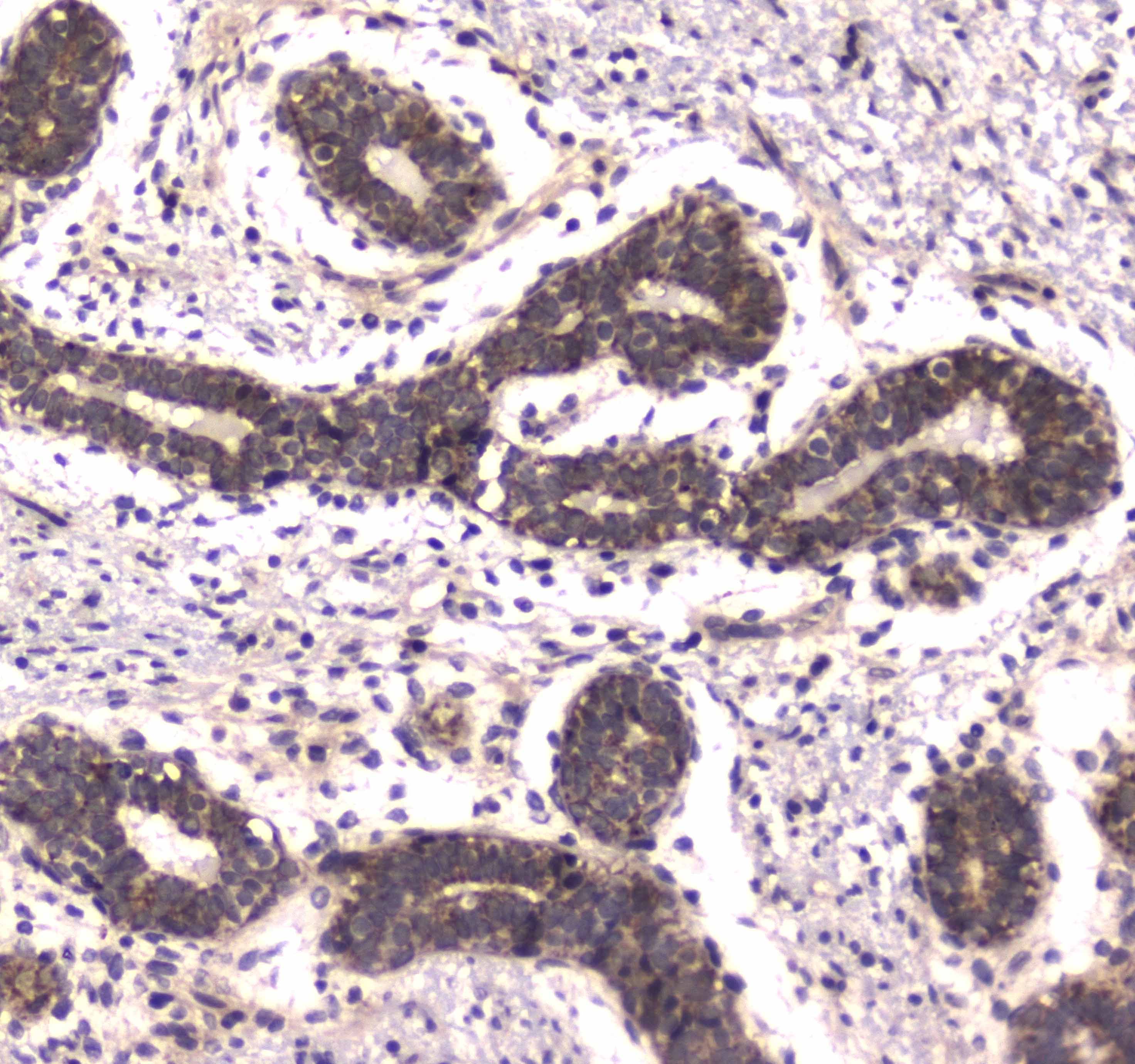 POLR2A / RNA polymerase II Antibody