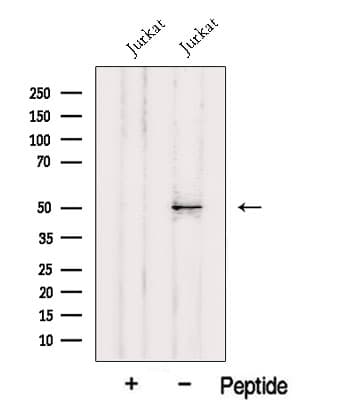 HMG20A Antibody