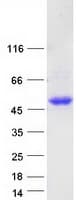 Human DCN / Decorin Protein (Recombinant Myc-DDK (Flag))