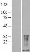 S100A9 / MRP14 Protein (Over-Expression Lysate Myc-DDK (Flag))