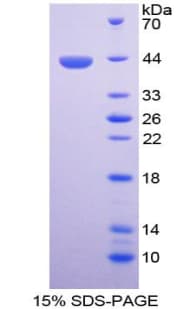 Bovine MGP / Matrix Gla-Protein (Recombinant His-GST)
