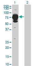 HAL / Histidine Ammonium Lyase Antibody (clone 4F2)