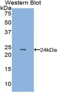 VEGFA / VEGF Antibody (aa27-214)