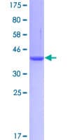 Human FABP4 / AP2 Protein (Recombinant GST)