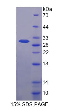 Mouse FBXW7 / FBW7 Protein (Recombinant His-T7)