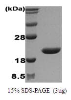 Human IL1RN Protein (Recombinant)