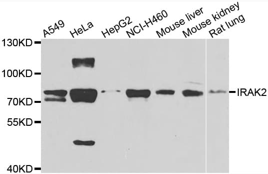 Polyclonal Rabbit anti-Human IRAK2 / IRAK-2 Antibody (IF, WB)