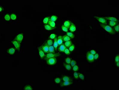 Polyclonal Rabbit anti-Human SHARPIN Antibody (IHC, IF, WB)