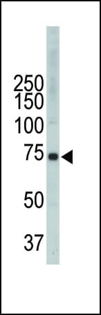 Polyclonal Rabbit anti-Human ITK / EMT Antibody (aa169-198, WB)