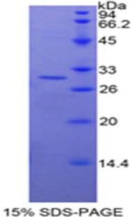 Human TOLLIP Protein (Recombinant His-T7)