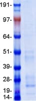 Human BST2 Protein (Recombinant Myc-DDK (Flag))