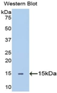 SEMA5B / Semaphorin 5B Antibody (aa36-161, PE)
