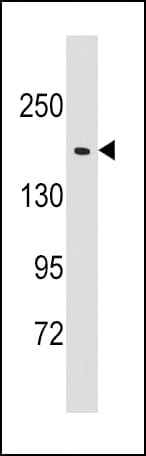 Polyclonal Rabbit anti-Human EPRS / PARS Antibody (aa285-314, IHC, WB)
