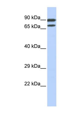 ZNF583 Antibody (aa72-121)