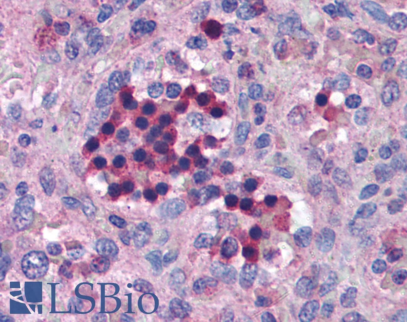 IHC-plus™ IRF7 Antibody