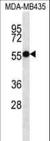 ASB4 Antibody (aa226-255)
