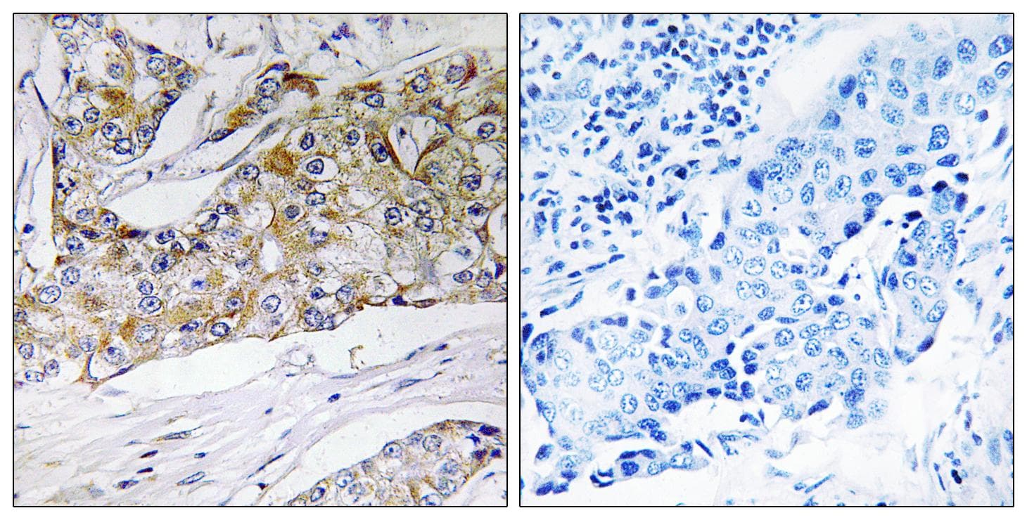 DHRS11 / MGC4172 Antibody