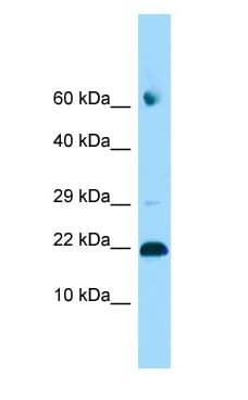Polyclonal Rabbit anti-Human ADAT2 Antibody (C-Terminus, WB)
