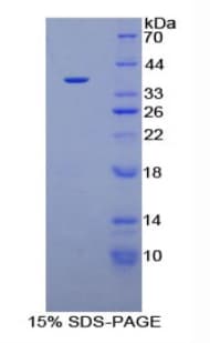 Human PLG / Plasmin / Plasminogen Protein (Recombinant His)