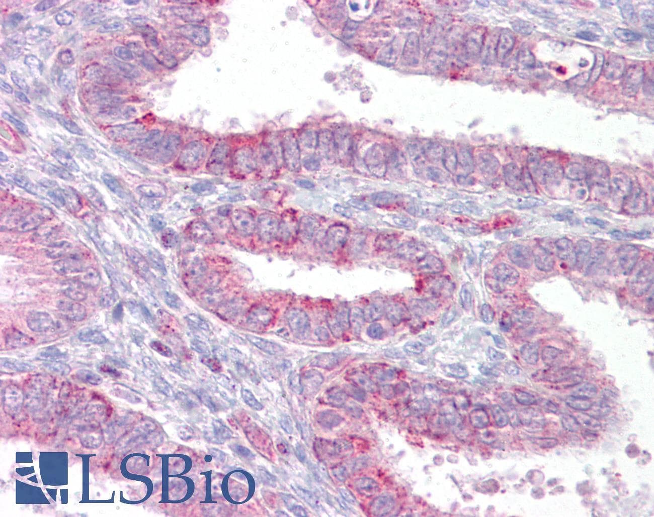 IHC-plus™ HMMR / CD168 / RHAMM Antibody
