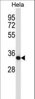 Polyclonal Rabbit anti-Mouse CSNK2A2 Antibody (aa4-32, WB)