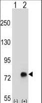 TGFBI Antibody (aa106-135)