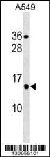 CCDC182 Antibody (aa 48-75, Internal)