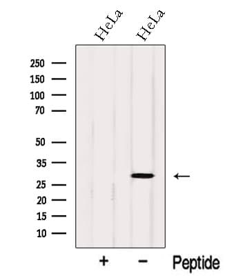 Polyclonal Rabbit anti-Human OCIAD1 Antibody (WB)