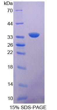 Rat PPOX Protein (Recombinant His-S)