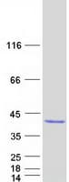 Human EXOSC8 Protein (Recombinant Myc-DDK (Flag))